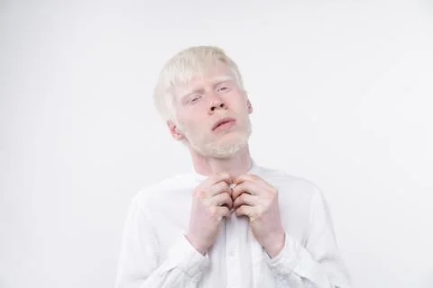 Portrait of an albino man in  studio dressed t-shirt isolated on a white back 写真素材