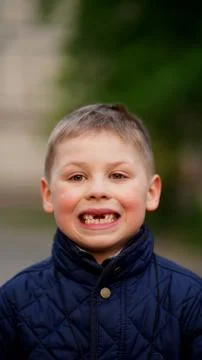 Portrait of a boy with fallen front teeth. Baby smiling 스톡 사진