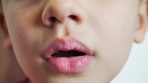 Portrait of a boy whose front teeth fell out. bad teeth Stock Footage 146505601