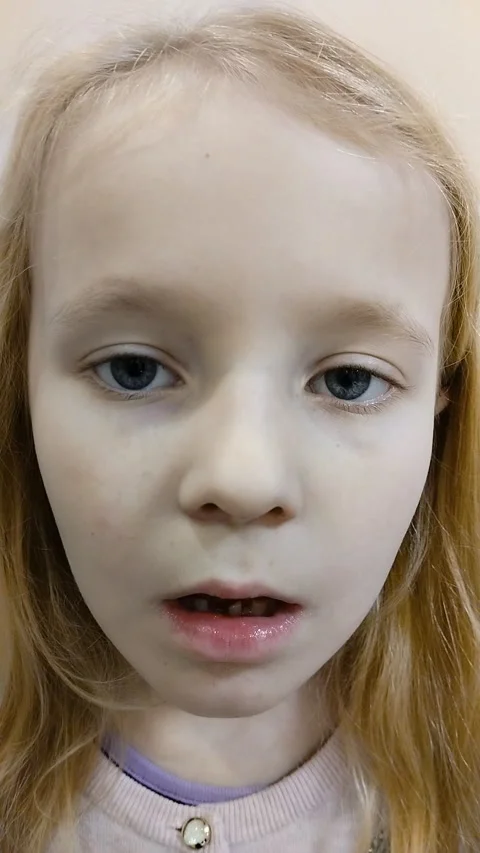 Portrait of a child with missing front teeth. Stock Footage 324756438