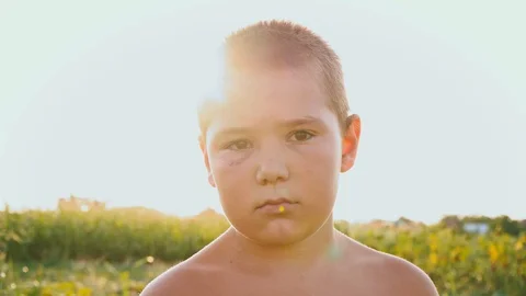 Portrait of a chubby boy with a black ey... | Stock Video | Pond5