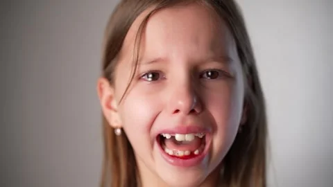 Portrait of a girl crying after pulling out her baby teeth, close-up. Stock Footage 274478030