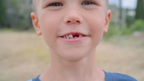 Portrait of Happy Laughing Boy with Missing Front Teeth Stock Footage 328235902