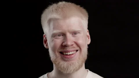 Portrait Of Smiling Albino Guy On Black ... | Stock Video | Pond5