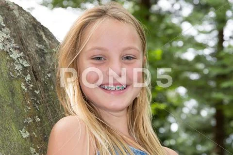 Portrait of smiling teen girl showing dental braces Stock Photos