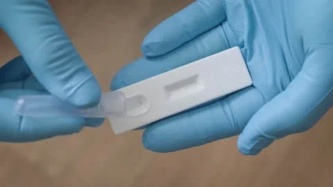 Positive antigen rapid test on COVID-19 coronavirus in hand of doctor Stock Footage 169279913
