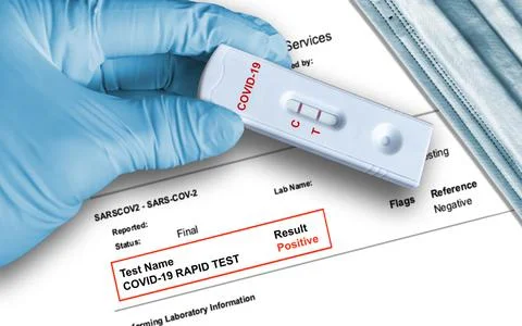 Positive antigen test result by using rapid self testing device for COVID-19, Stock Photos
