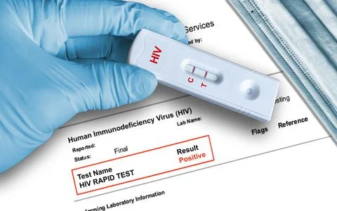 Positive antigen test result by using rapid self testing device for HIV Stock Photos