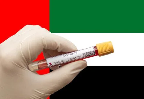 Positive COVID-19 blood test sample tube with National Flag Stock Photos
