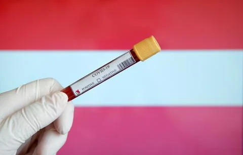 Positive COVID-19 blood test sample tube with National Flag Stock Photos