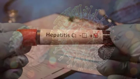 Positive Hepatitis C Blood Test Tube Over Virus Model Stock Footage 336900655
