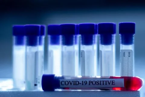 Positive test for Coronavirus Stock Photos