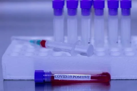 Positive test for Coronavirus Stock Photos