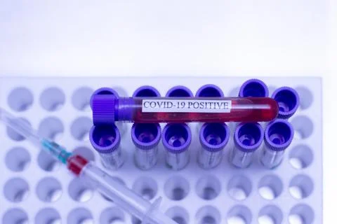 Positive test for Coronavirus Stock Photos