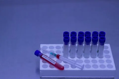 Positive test for Coronavirus Stock Photos