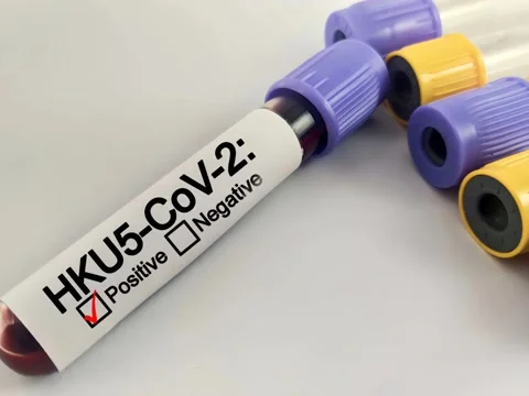 Positive test result for HKU5-CoV-2, coronavirus causing COVID-19 disease. Stock Footage 302819334