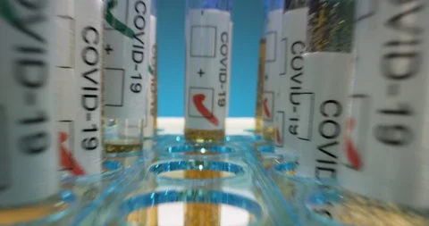 Positive testing for coronavirus in lab Stock Footage 127676171