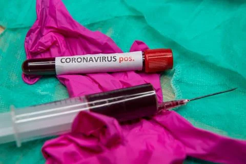 Positive testing at coronavirus Stock Photos