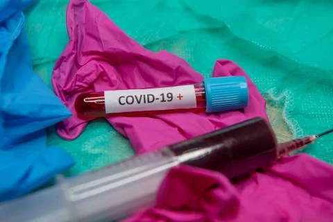 Positive testing at coronavirus Stock Photos