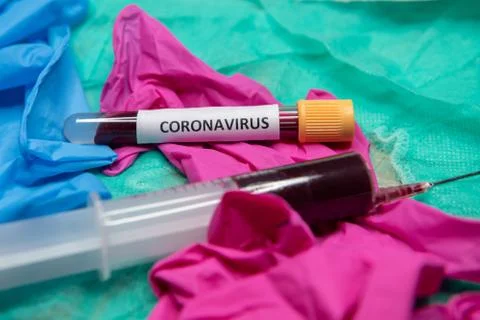 Positive testing at coronavirus Stock Photos