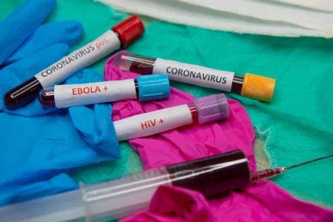 Positive testing at coronavirus Stock Photos