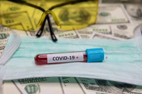 Positive testing at covid-19 Stock Photos