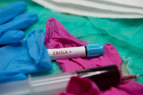 Positive testing at Ebola Stock Photos