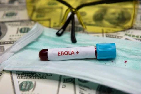 Positive testing at Ebola Stock Photos