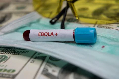 Positive testing at Ebola Stock Photos