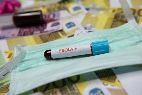 Positive testing at Ebola Stock Photos