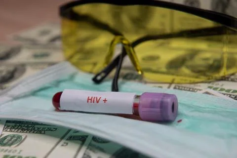 Positive testing at HIV Stock Photos