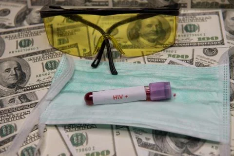 Positive testing at HIV Stock Photos
