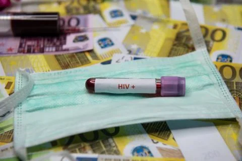 Positive testing at HIV Stock Photos