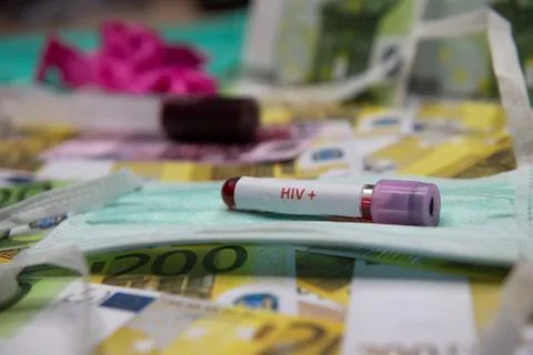 Positive testing at HIV Stock Photos