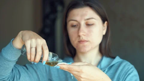 Post-acne, scars and red festering pimples on the face of a young woman. Video stock 105563262