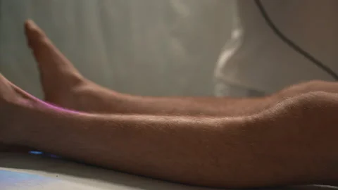 Post Apocalyptic Surgery On Legs Stock Footage 154875721