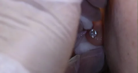 Post ear piercing site cleanup process Stock Footage 285294569