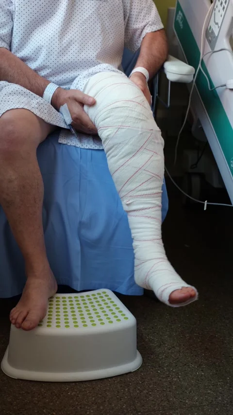 Post-op patient doing knee rehab exercises in a hospital chair. Stock Footage 310563652