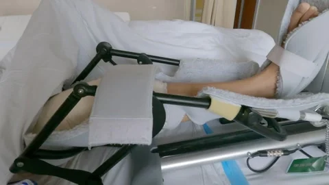 Post-operative physiotherapy after total knee replacement surgery. Stock Footage 241196122