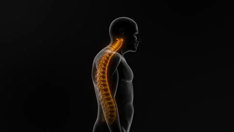 Postural syndrome or cervical postural dysfunction Stock-Footage 277674174