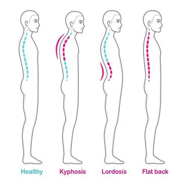 Posture and back problems spine infographic Stock Illustration