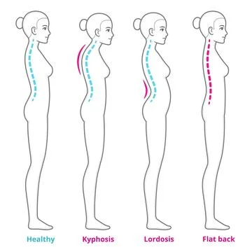 Posture and back problems spine infographic Stock Illustration