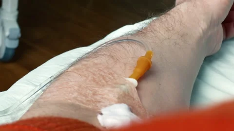 POV of a man's arm with an IV needle in the median cubital vein. Long angle view Stock Footage 257611328