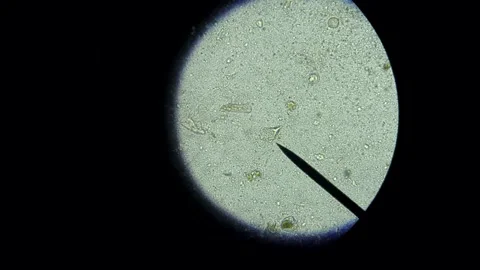 POV Microscope View of Moving Biological Microorganisms Видео 333178767