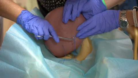 Practice of students of gynecological surgeons Vídeo Stock 202099133