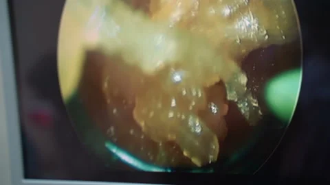 Practice of students of gynecological surgeons Stock Footage 202101260