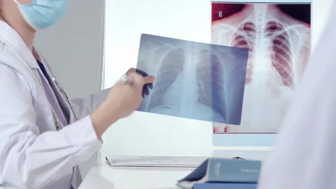 Practitioner doctor checking x-ray image of patient's lungs during health Stock Footage 329005070