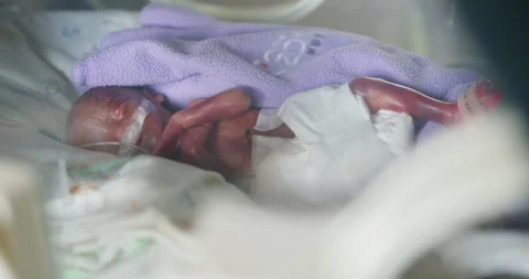 A precious newborn is currently being cared for in the Neonatal Care Unit of the 스톡 동영상 290838450