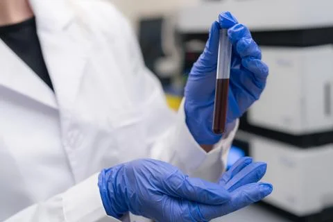 Precision laboratory technician analyzing blood sample in clinical testing 스톡 사진