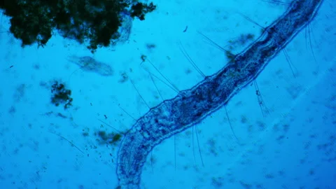 Predatory aquatic worm under a microscope. It is surrounded by bacteria, rotifer Stock Footage 159147857